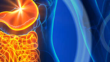 Inflammatory Bowel Disease