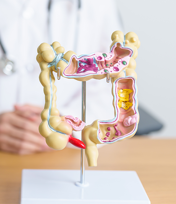 Refractory Constipation